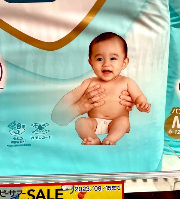 a diaper advertisement shows a baby's right arm appearing massive when compared to it's normal sized left arm